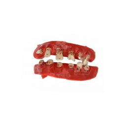 Deteriorated Pirate Teeth