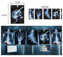 300cm X-ray garland.