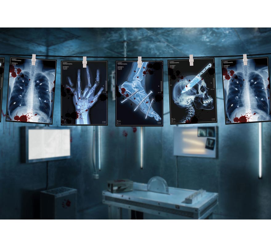 300cm X-ray garland.-B