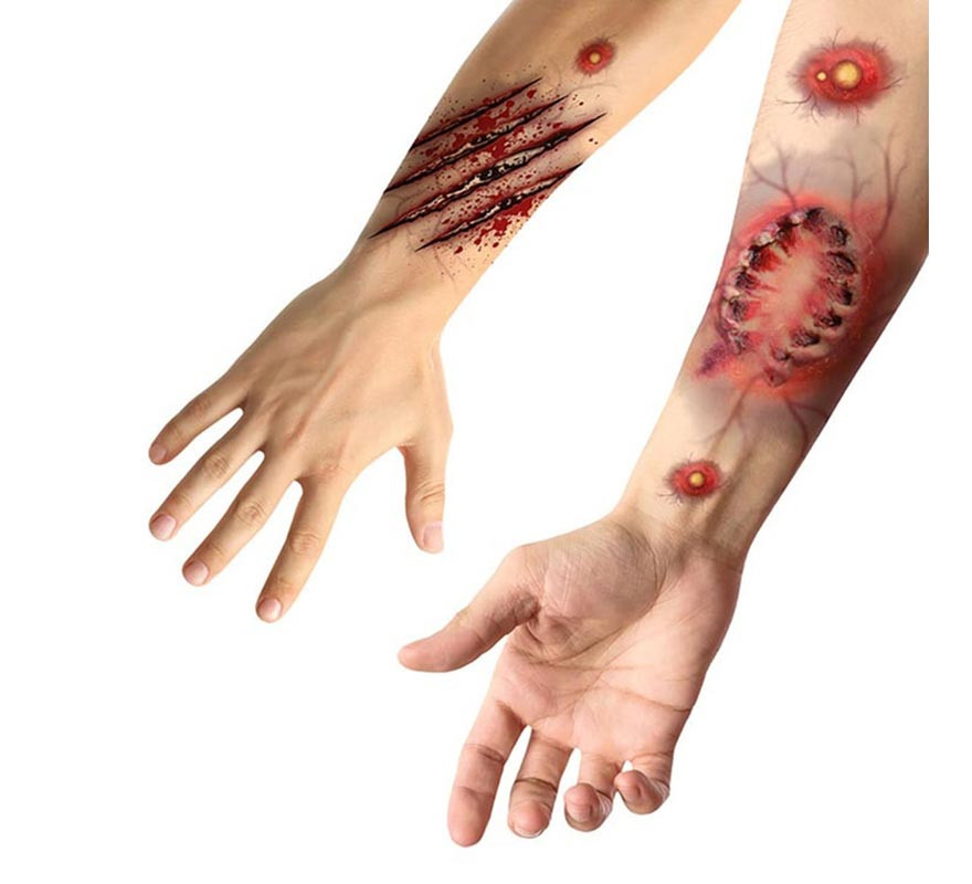 Adhesive Tattoos of Bite Wounds